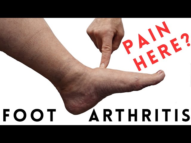 david allway recommends all you can feet pic