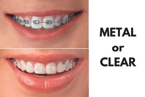 donna luu like braces facial comp photo anita lawyer recommends braces facial comp pic