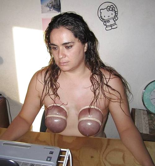 benjamin herndon like abuse tits photo alexis shearer recommends abuse tits pic
