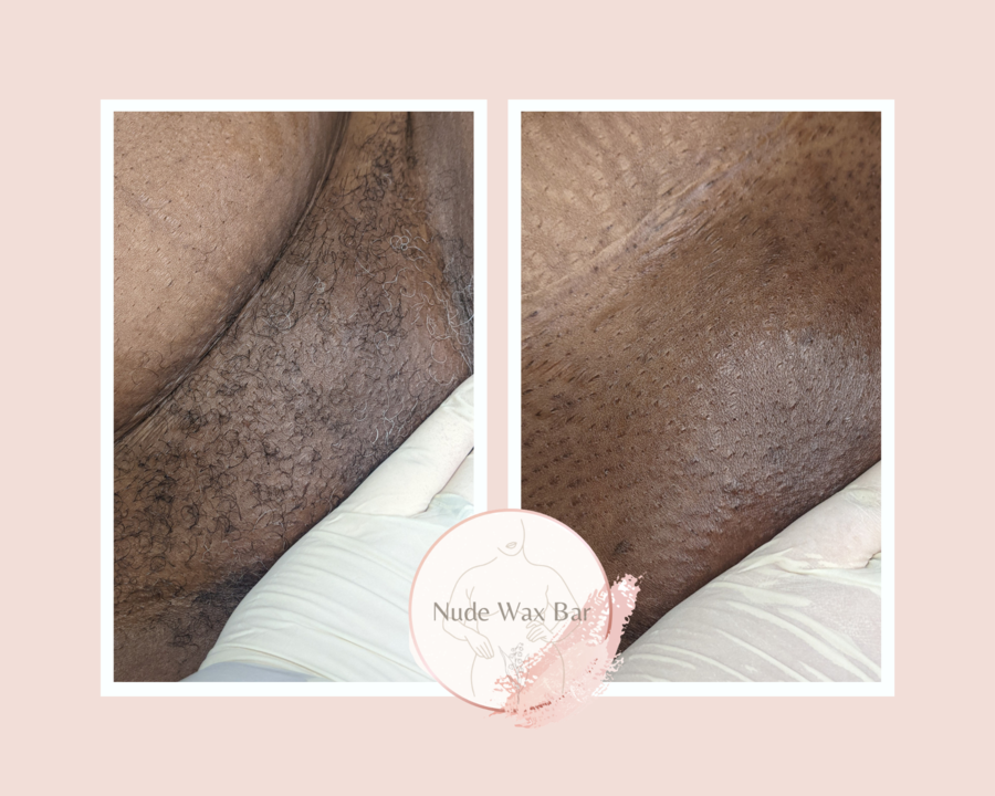 adnan silajdzic recommends Bikini Wax Nude