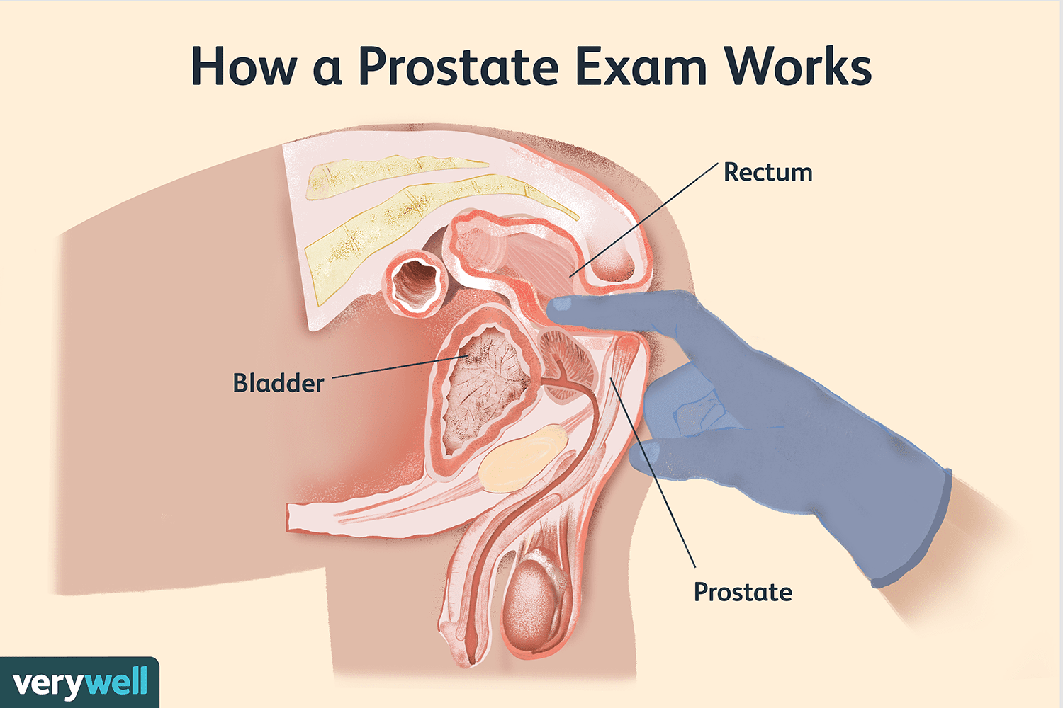 Best of Real penis exam