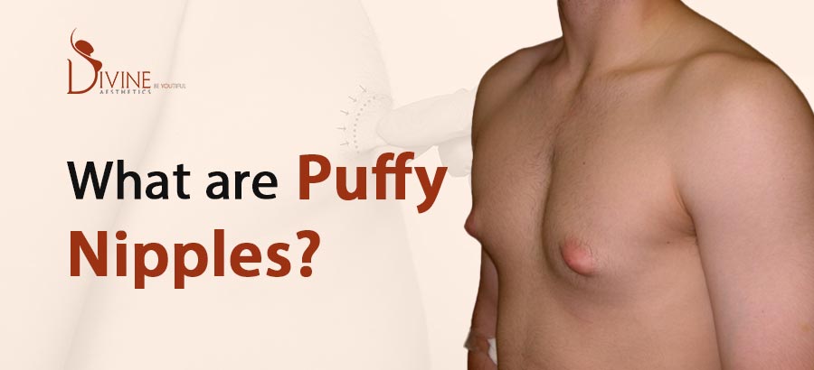 puffy women nipple