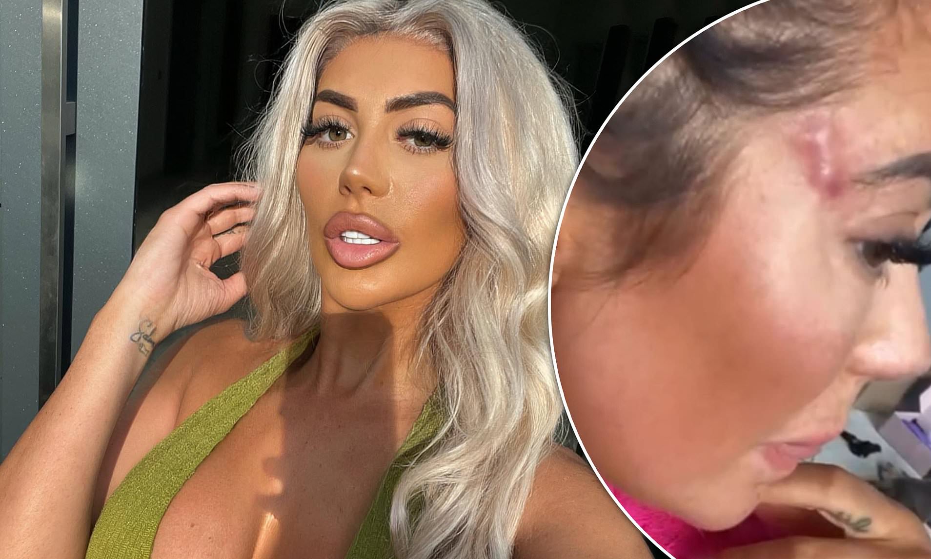 dennis ploutz recommends Chloe Foxy