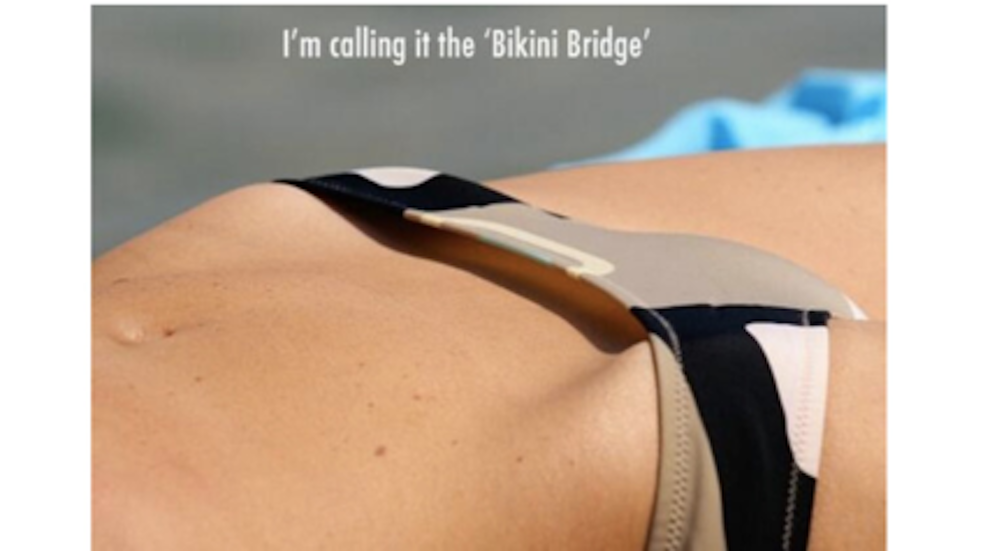 alyson adam recommends bikini bridge pictures pic