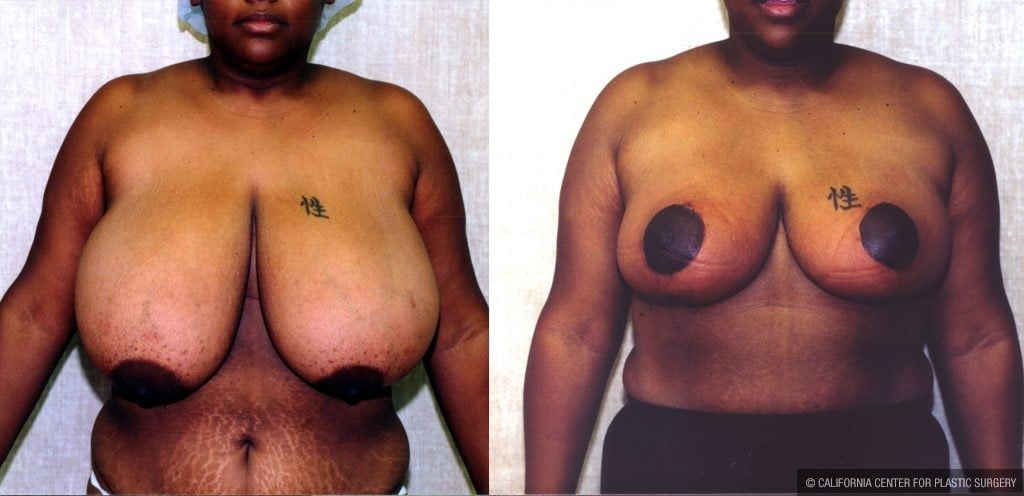 amy fones like tites saggy photo daniel cardoz recommends black ebony ts porn pic
