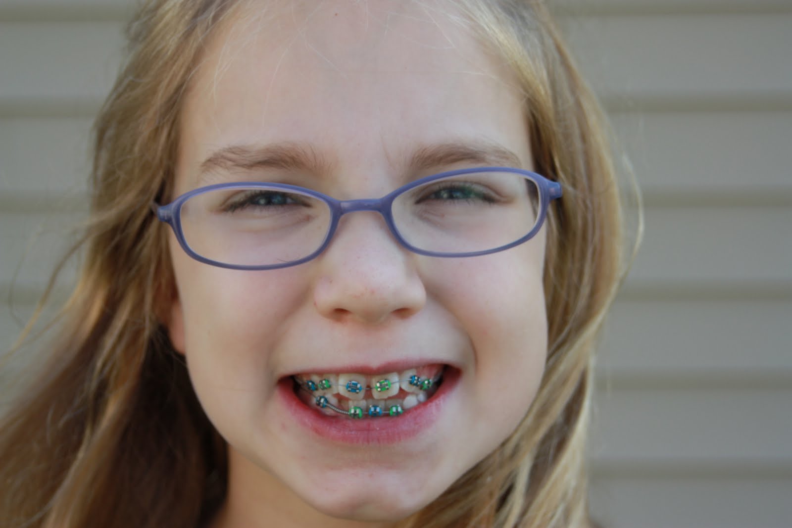 braces facial comp - milf dirty panty lexi luna new videos