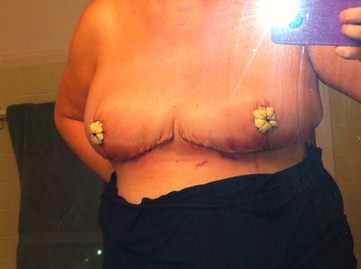 brigette adams recommends Biggest Nipples Ever