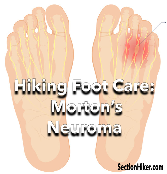 caitlin mcdaniel recommends alex chance feet pic