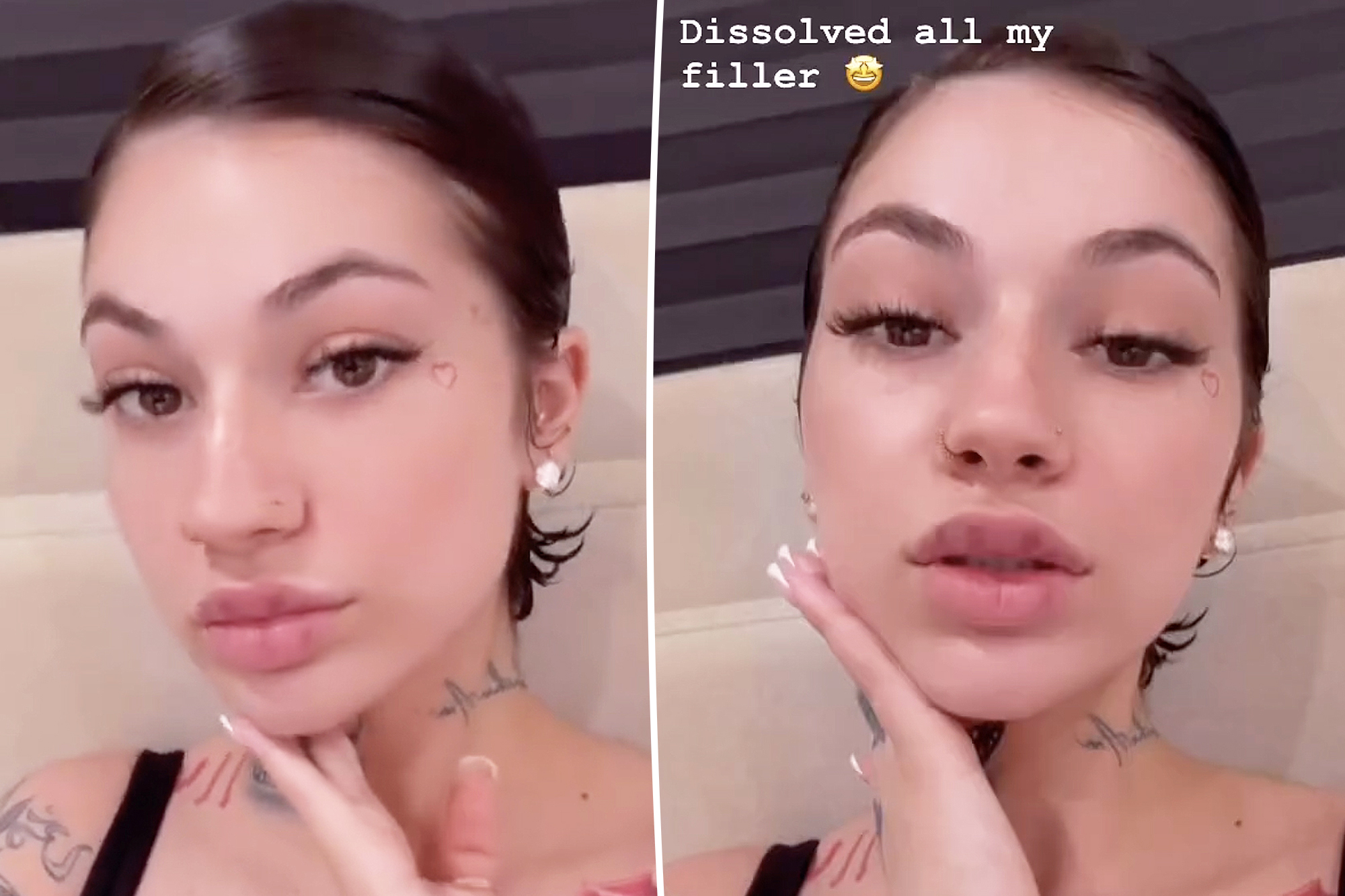 celia derbyshire like bhad bhabie lips photo ankit ajmani recommends bhad bhabie lips pic