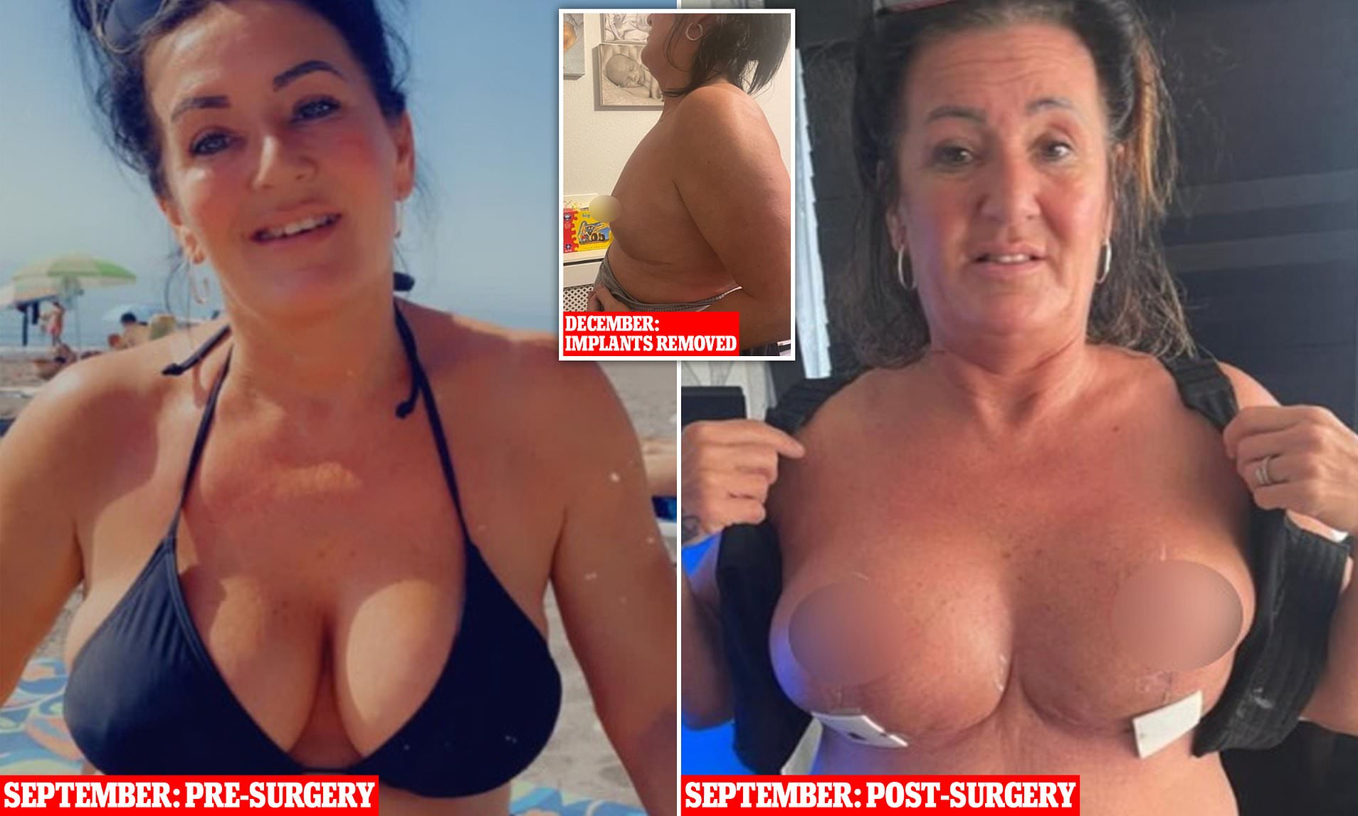 adrienne dabney like big turkish tits photo chris berrios recommends big turkish tits pic