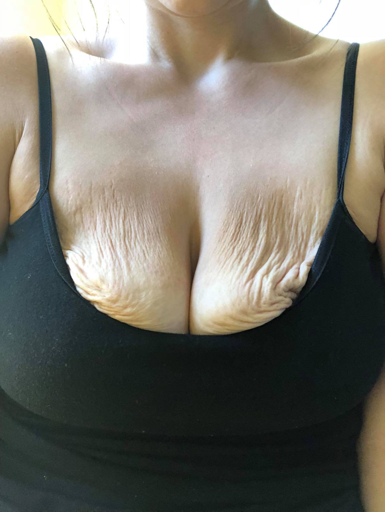 chasidy hall recommends Floppy Huge Tits